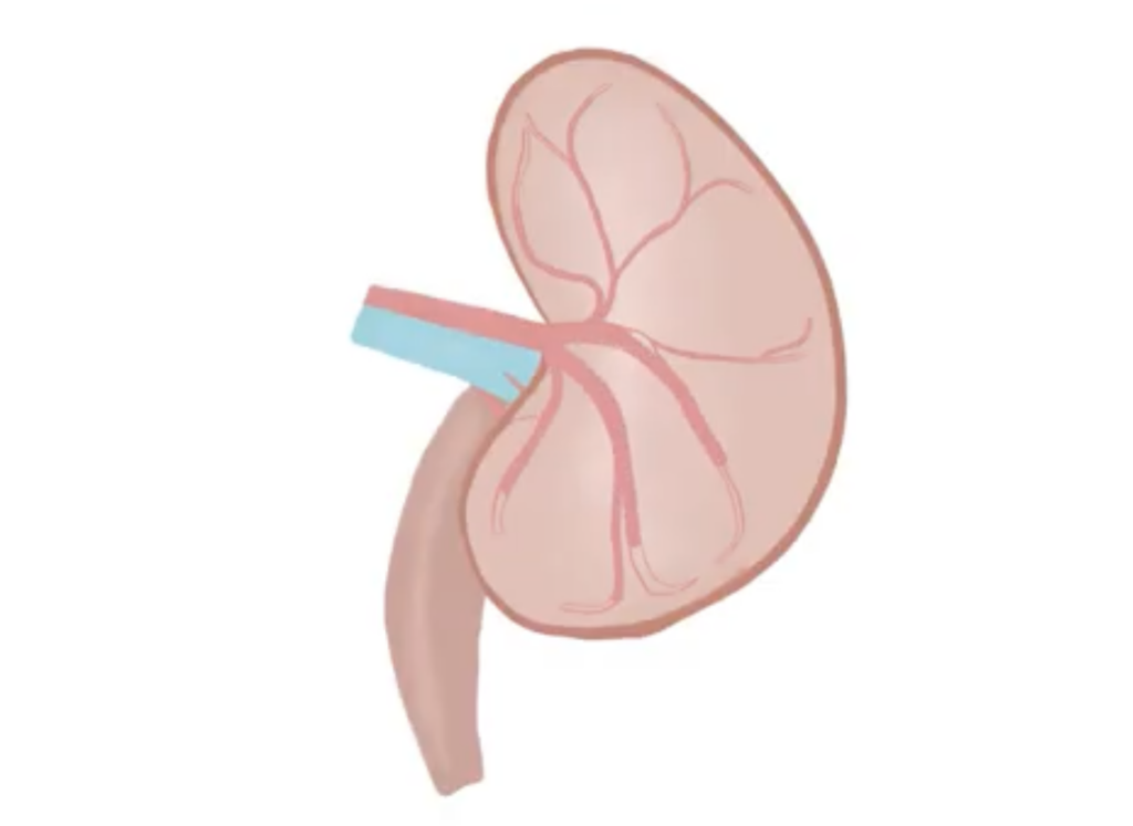 drawing of a kidney